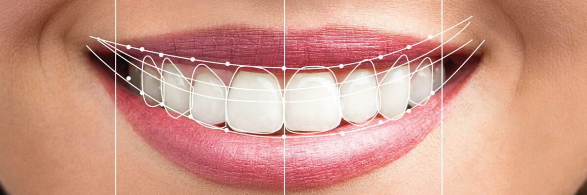 See your future smile with Digital Smile Design